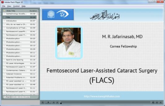فمتوسکندلیزر در جراحی کاتاراکت